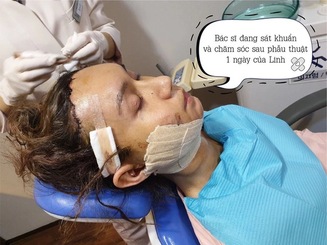 Hình Ảnh Phẫu Thuật Thẩm Mỹ Trước Sau: Tổng Hợp Kết Quả Thành Công Và Thất Bại Cho Người Quan Tâm Hình Ảnh Phẫu Thuật Thẩm Mỹ Trước Sau: Tổng Hợp Kết Quả Thành Công Và Thất Bại Cho Người Quan Tâm