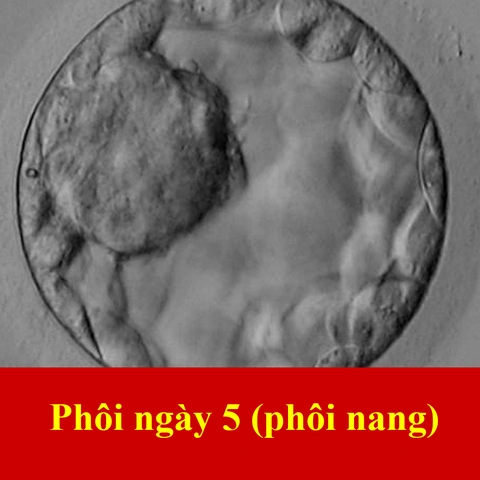100+ Hình Ảnh Phôi Ngày 5 2026 Đẹp Nhất, Sưu Tập Đầy Đủ Cho Mọi Nhu Cầu