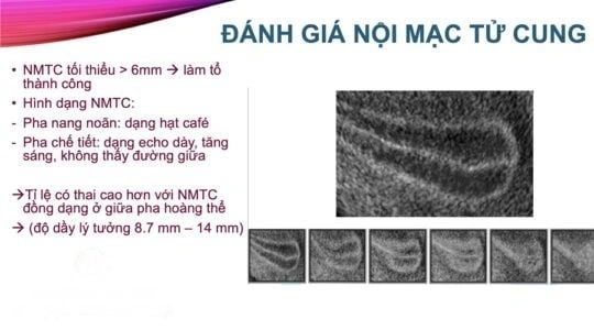 100+ Hình Ảnh Phôi Ngày 5 2026 Đẹp Nhất, Sưu Tập Đầy Đủ Cho Mọi Nhu Cầu