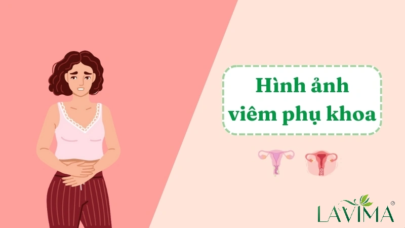100+ Hình Ảnh Phụ Khoa Đẹp 2026 – Bộ Sưu Tập Đầy Đủ, Chất Lượng Cao, Dễ Tải Ngay 100+ Hình Ảnh Phụ Khoa Đẹp 2026 – Bộ Sưu Tập Đầy Đủ, Chất Lượng Cao, Dễ Tải Ngay