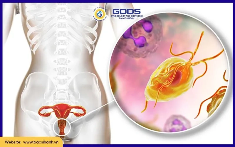 100+ Hình Ảnh Phụ Khoa Đẹp 2026 – Bộ Sưu Tập Đầy Đủ, Chất Lượng Cao, Dễ Tải Ngay 100+ Hình Ảnh Phụ Khoa Đẹp 2026 – Bộ Sưu Tập Đầy Đủ, Chất Lượng Cao, Dễ Tải Ngay