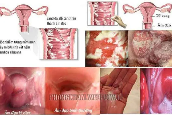 100+ Hình Ảnh Phụ Khoa Đẹp 2026 – Bộ Sưu Tập Đầy Đủ, Chất Lượng Cao, Dễ Tải Ngay 100+ Hình Ảnh Phụ Khoa Đẹp 2026 – Bộ Sưu Tập Đầy Đủ, Chất Lượng Cao, Dễ Tải Ngay
