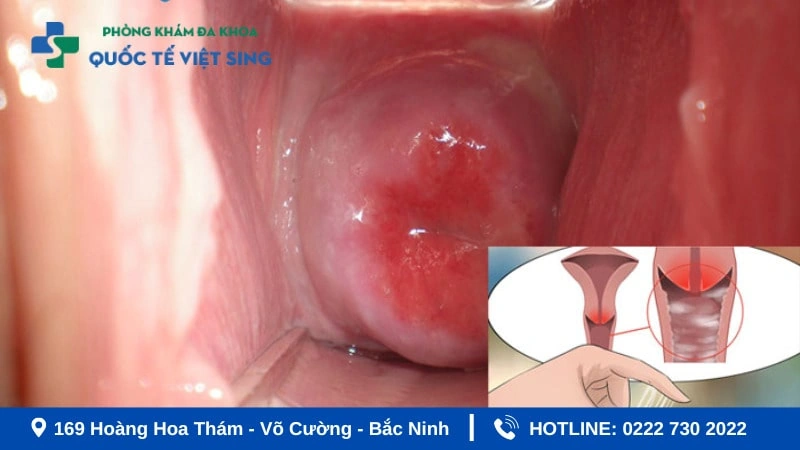 100+ Hình Ảnh Phụ Khoa Đẹp 2026 – Bộ Sưu Tập Đầy Đủ, Chất Lượng Cao, Dễ Tải Ngay 100+ Hình Ảnh Phụ Khoa Đẹp 2026 – Bộ Sưu Tập Đầy Đủ, Chất Lượng Cao, Dễ Tải Ngay