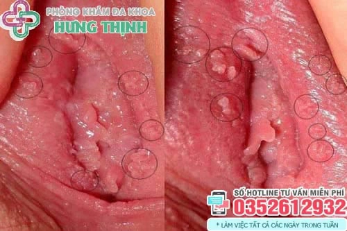 100+ Hình Ảnh Phụ Khoa Đẹp 2026 – Bộ Sưu Tập Đầy Đủ, Chất Lượng Cao, Dễ Tải Ngay 100+ Hình Ảnh Phụ Khoa Đẹp 2026 – Bộ Sưu Tập Đầy Đủ, Chất Lượng Cao, Dễ Tải Ngay