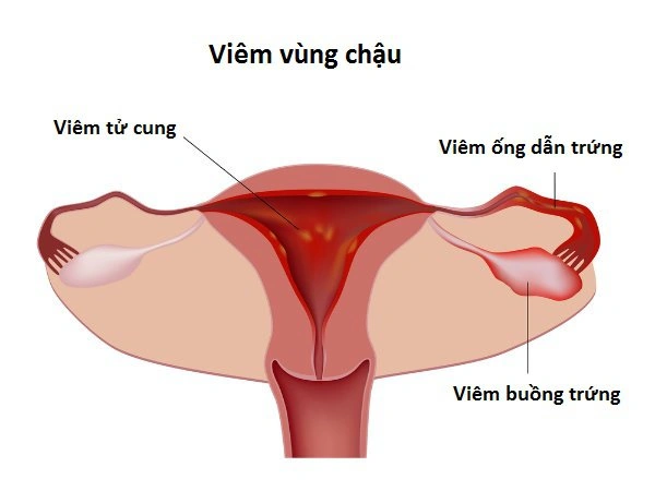 100+ Hình Ảnh Phụ Khoa Đẹp 2026 – Bộ Sưu Tập Đầy Đủ, Chất Lượng Cao, Dễ Tải Ngay 100+ Hình Ảnh Phụ Khoa Đẹp 2026 – Bộ Sưu Tập Đầy Đủ, Chất Lượng Cao, Dễ Tải Ngay