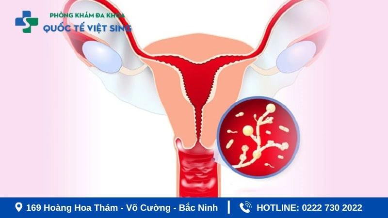 100+ Hình Ảnh Phụ Khoa Đẹp 2026 – Bộ Sưu Tập Đầy Đủ, Chất Lượng Cao, Dễ Tải Ngay 100+ Hình Ảnh Phụ Khoa Đẹp 2026 – Bộ Sưu Tập Đầy Đủ, Chất Lượng Cao, Dễ Tải Ngay