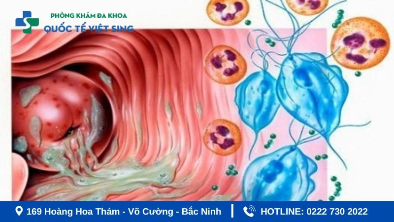 100+ Hình Ảnh Phụ Khoa Đẹp 2026 – Bộ Sưu Tập Đầy Đủ, Chất Lượng Cao, Dễ Tải Ngay 100+ Hình Ảnh Phụ Khoa Đẹp 2026 – Bộ Sưu Tập Đầy Đủ, Chất Lượng Cao, Dễ Tải Ngay