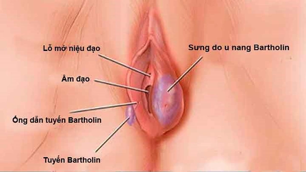 100+ Hình Ảnh Phụ Khoa Đẹp 2026 – Bộ Sưu Tập Đầy Đủ, Chất Lượng Cao, Dễ Tải Ngay 100+ Hình Ảnh Phụ Khoa Đẹp 2026 – Bộ Sưu Tập Đầy Đủ, Chất Lượng Cao, Dễ Tải Ngay