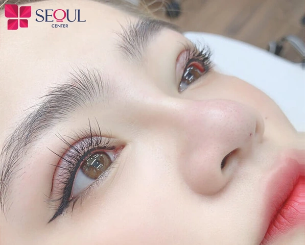 Xem Hình Ảnh Phun Mí Mở Tròng Đẹp Nhất: Bộ Sưu Tập Thực Tế & Hướng Dẫn Cho Người Muốn Tăng Độ Sắc Nét Xem Hình Ảnh Phun Mí Mở Tròng Đẹp Nhất: Bộ Sưu Tập Thực Tế & Hướng Dẫn Cho Người Muốn Tăng Độ Sắc Nét