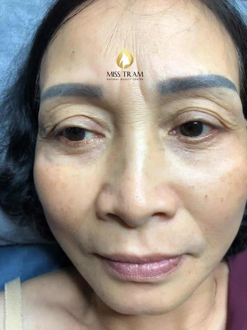 Xem Hình Ảnh Phun Mí Mở Tròng Đẹp Nhất: Bộ Sưu Tập Thực Tế & Hướng Dẫn Cho Người Muốn Tăng Độ Sắc Nét Xem Hình Ảnh Phun Mí Mở Tròng Đẹp Nhất: Bộ Sưu Tập Thực Tế & Hướng Dẫn Cho Người Muốn Tăng Độ Sắc Nét