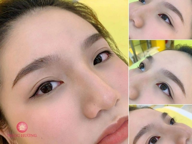 Xem Hình Ảnh Phun Mí Mở Tròng Đẹp Nhất: Bộ Sưu Tập Thực Tế & Hướng Dẫn Cho Người Muốn Tăng Độ Sắc Nét Xem Hình Ảnh Phun Mí Mở Tròng Đẹp Nhất: Bộ Sưu Tập Thực Tế & Hướng Dẫn Cho Người Muốn Tăng Độ Sắc Nét