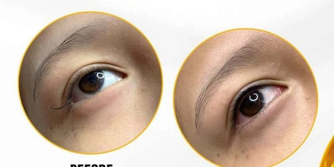 Xem Hình Ảnh Phun Mí Mở Tròng Đẹp Nhất: Bộ Sưu Tập Thực Tế & Hướng Dẫn Cho Người Muốn Tăng Độ Sắc Nét Xem Hình Ảnh Phun Mí Mở Tròng Đẹp Nhất: Bộ Sưu Tập Thực Tế & Hướng Dẫn Cho Người Muốn Tăng Độ Sắc Nét