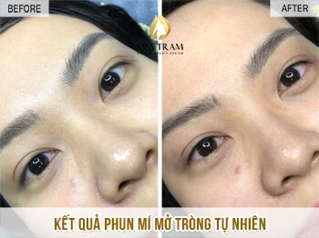 Xem Hình Ảnh Phun Mí Mở Tròng Đẹp Nhất: Bộ Sưu Tập Thực Tế & Hướng Dẫn Cho Người Muốn Tăng Độ Sắc Nét Xem Hình Ảnh Phun Mí Mở Tròng Đẹp Nhất: Bộ Sưu Tập Thực Tế & Hướng Dẫn Cho Người Muốn Tăng Độ Sắc Nét