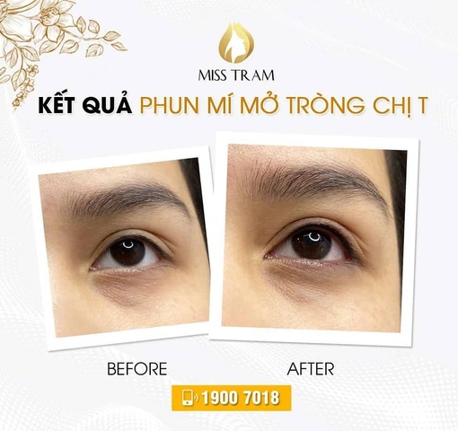 Xem Hình Ảnh Phun Mí Mở Tròng Đẹp Nhất: Bộ Sưu Tập Thực Tế & Hướng Dẫn Cho Người Muốn Tăng Độ Sắc Nét Xem Hình Ảnh Phun Mí Mở Tròng Đẹp Nhất: Bộ Sưu Tập Thực Tế & Hướng Dẫn Cho Người Muốn Tăng Độ Sắc Nét