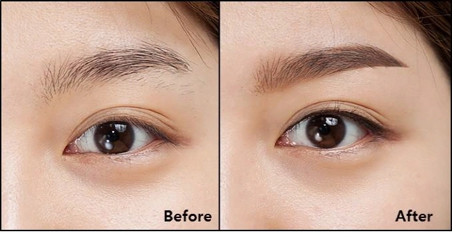Xem Hình Ảnh Phun Mí Mở Tròng Đẹp Nhất: Bộ Sưu Tập Thực Tế & Hướng Dẫn Cho Người Muốn Tăng Độ Sắc Nét Xem Hình Ảnh Phun Mí Mở Tròng Đẹp Nhất: Bộ Sưu Tập Thực Tế & Hướng Dẫn Cho Người Muốn Tăng Độ Sắc Nét