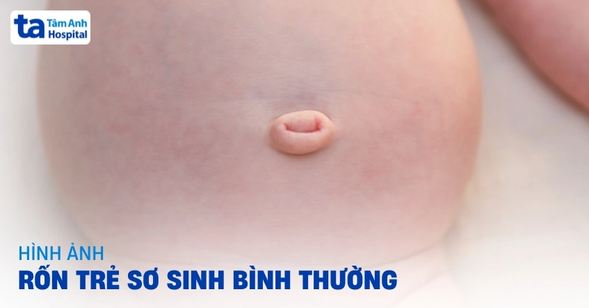 100+ Hình Ảnh Rốn Ngửa 2026 Đẹp Nhất, 100+ Bức Ảnh Rốn Ngửa Đầy Sắc Màu Và Cảm Hứng, 100+ Hình Ảnh Rốn Ngửa Độc Đáo Khiến Bạn Không Thể Rời Mắt