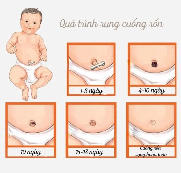 100+ Hình Ảnh Rốn Ngửa 2026 Đẹp Nhất, 100+ Bức Ảnh Rốn Ngửa Đầy Sắc Màu Và Cảm Hứng, 100+ Hình Ảnh Rốn Ngửa Độc Đáo Khiến Bạn Không Thể Rời Mắt