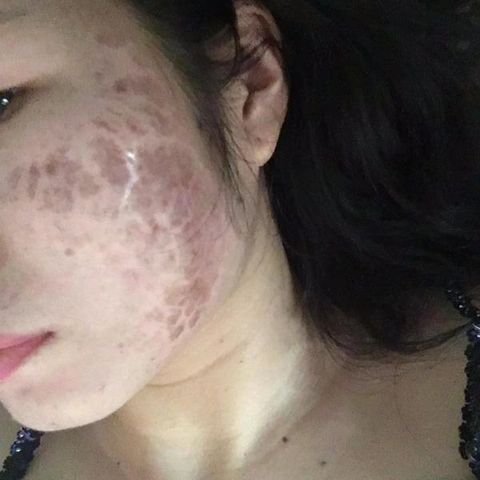 100+ Hình Ảnh Sau Phi Kim 2026 – Bộ Sưu Tập Đẹp Nhất, 100+ Cảnh Sau Phi Kim Độc Đáo, Bạn Đã Xem Chưa? 100+ Hình Ảnh Sau Phi Kim 2026 – Bộ Sưu Tập Đẹp Nhất, 100+ Cảnh Sau Phi Kim Độc Đáo, Bạn Đã Xem Chưa?