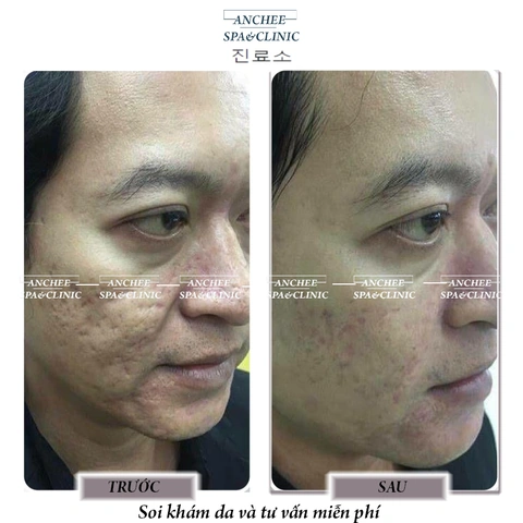 100+ Hình Ảnh Sau Phi Kim 2026 – Bộ Sưu Tập Đẹp Nhất, 100+ Cảnh Sau Phi Kim Độc Đáo, Bạn Đã Xem Chưa? 100+ Hình Ảnh Sau Phi Kim 2026 – Bộ Sưu Tập Đẹp Nhất, 100+ Cảnh Sau Phi Kim Độc Đáo, Bạn Đã Xem Chưa?