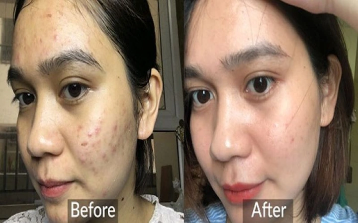100+ Hình Ảnh Sau Phi Kim 2026 – Bộ Sưu Tập Đẹp Nhất, 100+ Cảnh Sau Phi Kim Độc Đáo, Bạn Đã Xem Chưa? 100+ Hình Ảnh Sau Phi Kim 2026 – Bộ Sưu Tập Đẹp Nhất, 100+ Cảnh Sau Phi Kim Độc Đáo, Bạn Đã Xem Chưa?