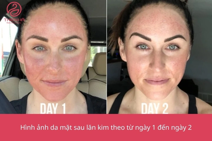 100+ Hình Ảnh Sau Phi Kim 2026 – Bộ Sưu Tập Đẹp Nhất, 100+ Cảnh Sau Phi Kim Độc Đáo, Bạn Đã Xem Chưa? 100+ Hình Ảnh Sau Phi Kim 2026 – Bộ Sưu Tập Đẹp Nhất, 100+ Cảnh Sau Phi Kim Độc Đáo, Bạn Đã Xem Chưa?