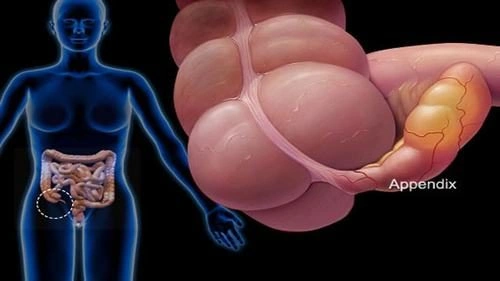 Hình Ảnh Siêu Âm Viêm Ruột Thừa: Cách Đọc, Chuẩn Đoán Và Lưu Ý Cho Bác Sĩ & Bệnh Nhân Hình Ảnh Siêu Âm Viêm Ruột Thừa: Cách Đọc, Chuẩn Đoán Và Lưu Ý Cho Bác Sĩ & Bệnh Nhân