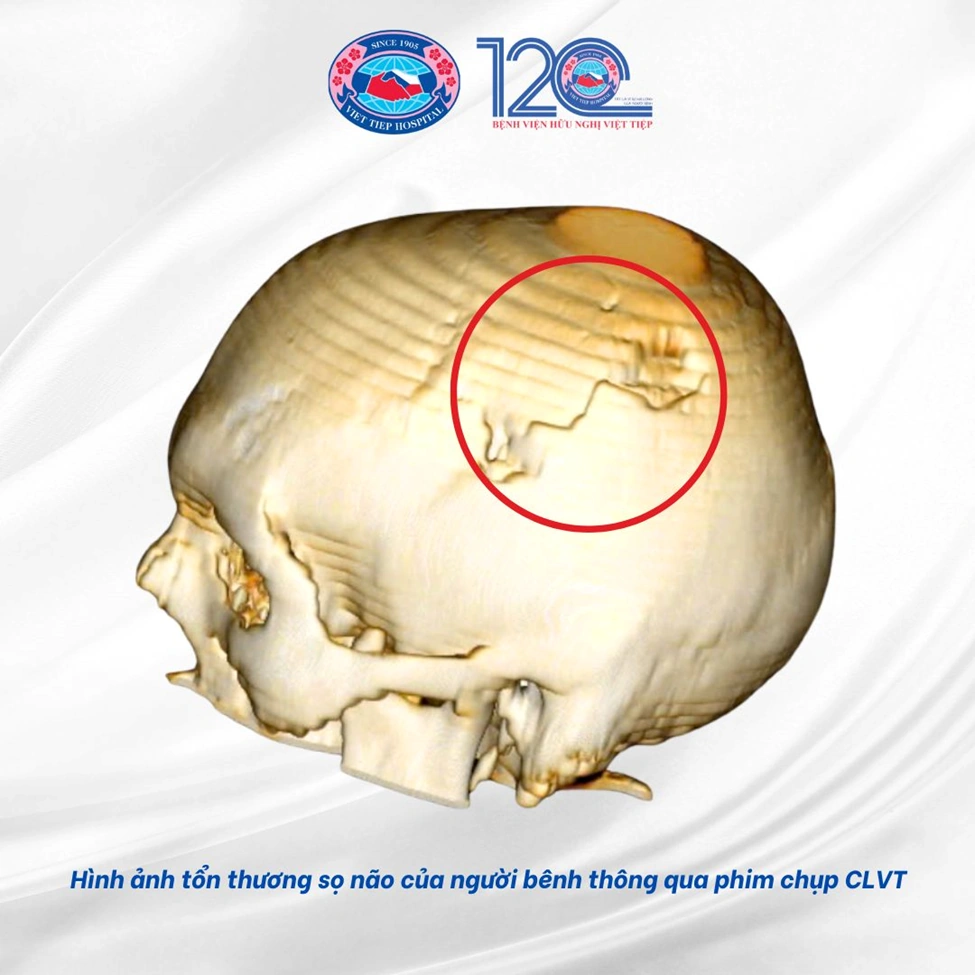 100+ Hình Ảnh Sọ Người 4k Đẹp Nhất 2026 – Bộ Sưu Tập Độc Đáo Dành Cho Mọi Nhu Cầu
