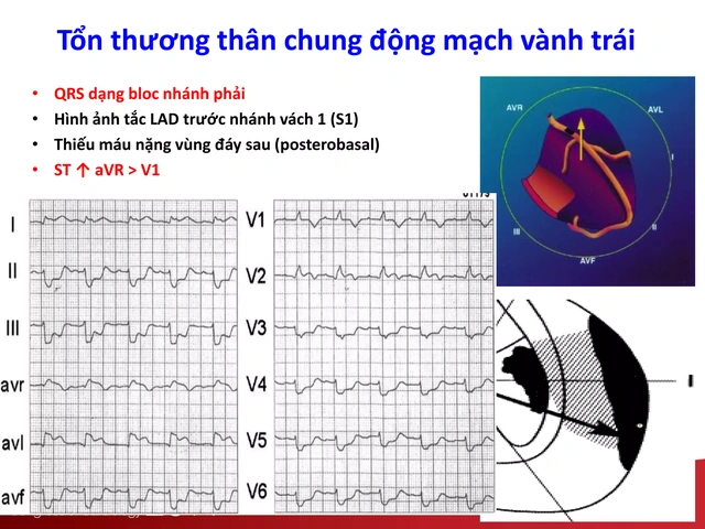 100+ Hình Ảnh Soi Gương Ecg 2026 - Bộ Sưu Tập Đầy Đủ, Đẹp Nhất? 100+ Hình Ảnh Soi Gương Ecg 2026 - Bộ Sưu Tập Đầy Đủ, Đẹp Nhất?