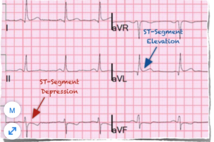 100+ Hình Ảnh Soi Gương Ecg 2026 - Bộ Sưu Tập Đầy Đủ, Đẹp Nhất? 100+ Hình Ảnh Soi Gương Ecg 2026 - Bộ Sưu Tập Đầy Đủ, Đẹp Nhất?