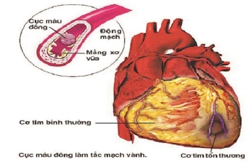 100+ Hình Ảnh Soi Gương Ecg 2026 - Bộ Sưu Tập Đầy Đủ, Đẹp Nhất? 100+ Hình Ảnh Soi Gương Ecg 2026 - Bộ Sưu Tập Đầy Đủ, Đẹp Nhất?