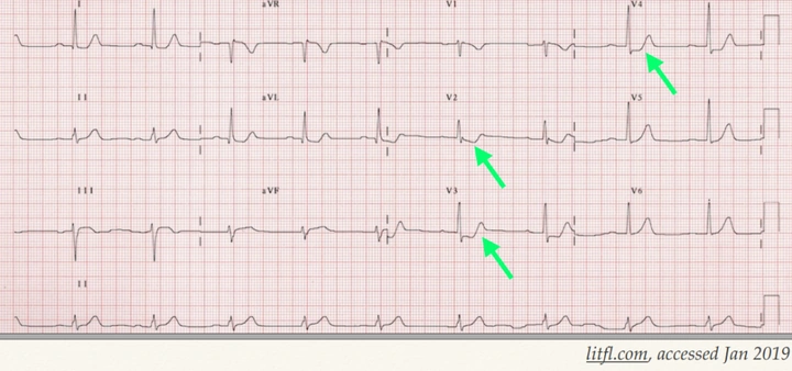 100+ Hình Ảnh Soi Gương Ecg 2026 - Bộ Sưu Tập Đầy Đủ, Đẹp Nhất? 100+ Hình Ảnh Soi Gương Ecg 2026 - Bộ Sưu Tập Đầy Đủ, Đẹp Nhất?
