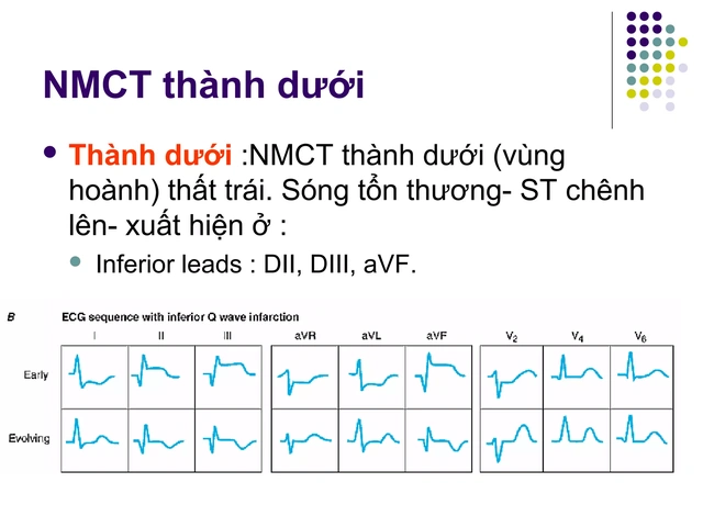 100+ Hình Ảnh Soi Gương Ecg 2026 - Bộ Sưu Tập Đầy Đủ, Đẹp Nhất? 100+ Hình Ảnh Soi Gương Ecg 2026 - Bộ Sưu Tập Đầy Đủ, Đẹp Nhất?