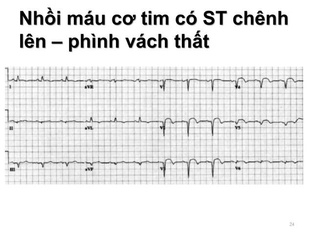 100+ Hình Ảnh Soi Gương Ecg 2026 - Bộ Sưu Tập Đầy Đủ, Đẹp Nhất? 100+ Hình Ảnh Soi Gương Ecg 2026 - Bộ Sưu Tập Đầy Đủ, Đẹp Nhất?