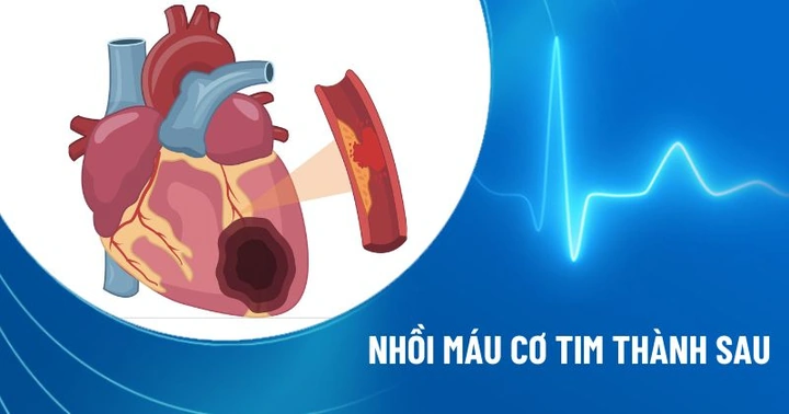 100+ Hình Ảnh Soi Gương Ecg 2026 - Bộ Sưu Tập Đầy Đủ, Đẹp Nhất? 100+ Hình Ảnh Soi Gương Ecg 2026 - Bộ Sưu Tập Đầy Đủ, Đẹp Nhất?