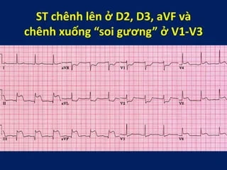 100+ Hình Ảnh Soi Gương Ecg 2026 - Bộ Sưu Tập Đầy Đủ, Đẹp Nhất? 100+ Hình Ảnh Soi Gương Ecg 2026 - Bộ Sưu Tập Đầy Đủ, Đẹp Nhất?