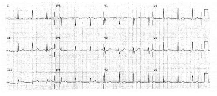 100+ Hình Ảnh Soi Gương Ecg 2026 - Bộ Sưu Tập Đầy Đủ, Đẹp Nhất? 100+ Hình Ảnh Soi Gương Ecg 2026 - Bộ Sưu Tập Đầy Đủ, Đẹp Nhất?