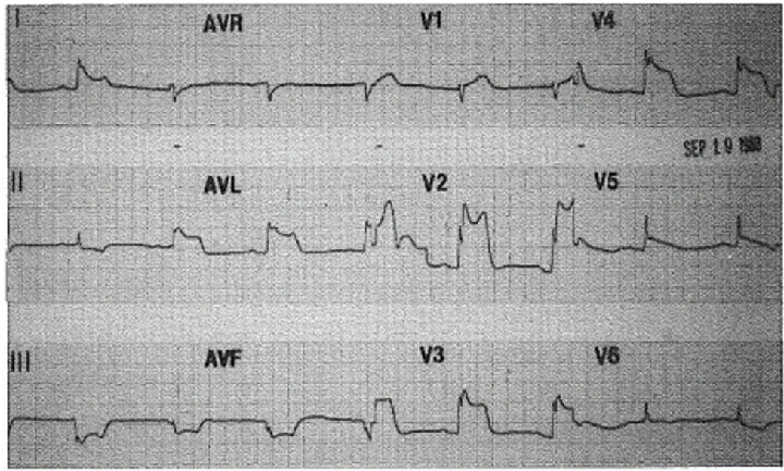 100+ Hình Ảnh Soi Gương Ecg 2026 - Bộ Sưu Tập Đầy Đủ, Đẹp Nhất? 100+ Hình Ảnh Soi Gương Ecg 2026 - Bộ Sưu Tập Đầy Đủ, Đẹp Nhất?