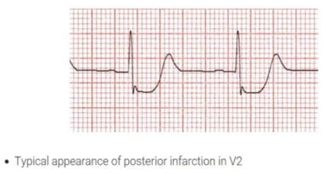 100+ Hình Ảnh Soi Gương Ecg 2026 - Bộ Sưu Tập Đầy Đủ, Đẹp Nhất? 100+ Hình Ảnh Soi Gương Ecg 2026 - Bộ Sưu Tập Đầy Đủ, Đẹp Nhất?