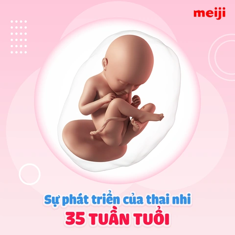 100+ Hình Ảnh Thai 35 Tuần Full Hd 2026 – Bộ Sưu Tập Đẹp Nhất, Siêu Đẹp Khiến Mẹ Bầu Rạng Rỡ, 100+ Bức Ảnh Thai Kỳ Đặc Biệt Cho Mọi Nhu Cầu