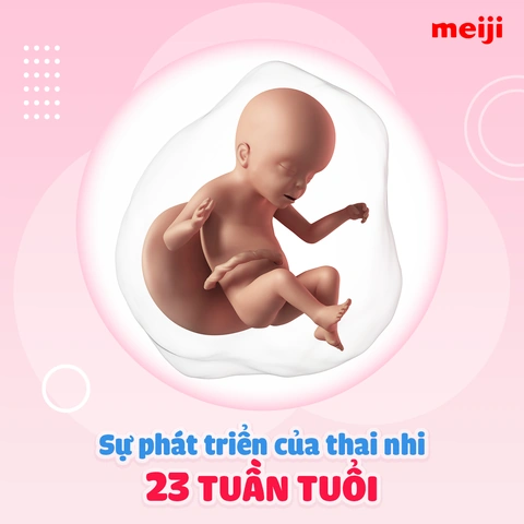 Khám Phá Hình Ảnh Thai Nhi 23 Tuần: Sự Phát Triển, Chỉ Số Siêu Âm & Lưu Ý Cho Mẹ Bầu Khám Phá Hình Ảnh Thai Nhi 23 Tuần: Sự Phát Triển, Chỉ Số Siêu Âm & Lưu Ý Cho Mẹ Bầu