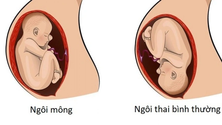 Khám Phá Hình Ảnh Thai Nhi 23 Tuần: Sự Phát Triển, Chỉ Số Siêu Âm & Lưu Ý Cho Mẹ Bầu Khám Phá Hình Ảnh Thai Nhi 23 Tuần: Sự Phát Triển, Chỉ Số Siêu Âm & Lưu Ý Cho Mẹ Bầu