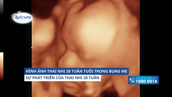 Hình Ảnh Thai Nhi 28 Tuần Tuổi: Tiểu Thuyết Phát Triển, Đo Lường & Những Thay Đổi Quan Trọng Cho Mẹ Bầu Hình Ảnh Thai Nhi 28 Tuần Tuổi: Tiểu Thuyết Phát Triển, Đo Lường & Những Thay Đổi Quan Trọng Cho Mẹ Bầu