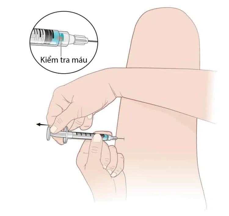 100+ Hình Ảnh Tiêm Bắp 2026 Đầy Đủ, Chất Lượng Cao, Dễ Dàng Tải Về 100+ Hình Ảnh Tiêm Bắp 2026 Đầy Đủ, Chất Lượng Cao, Dễ Dàng Tải Về