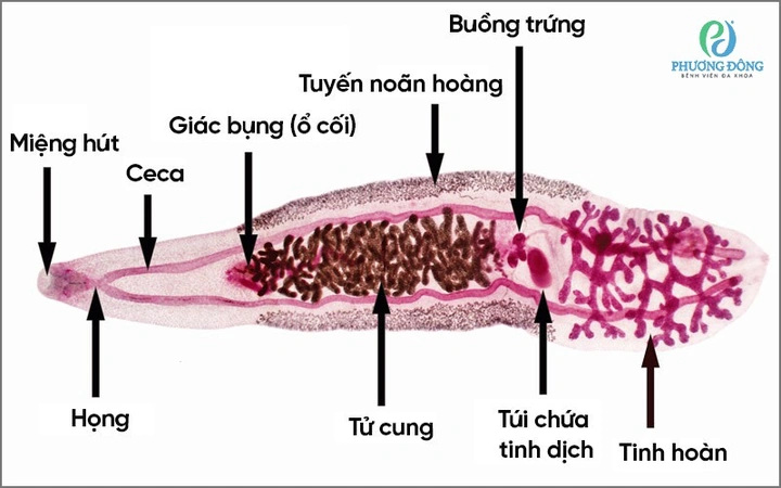 Hình Ảnh Trứng Sán Lá Gan Nhỏ: Đặc Điểm, Chẩn Đoán Và Phòng Ngừa Cho Người Bệnh