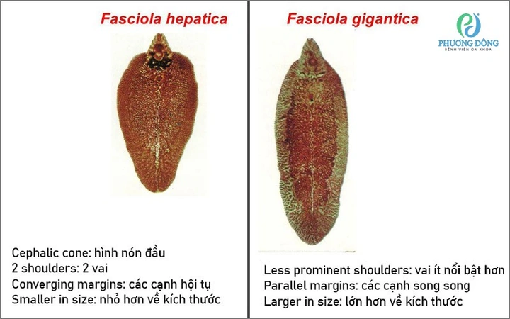 Hình Ảnh Trứng Sán Lá Gan Nhỏ: Đặc Điểm, Chẩn Đoán Và Phòng Ngừa Cho Người Bệnh