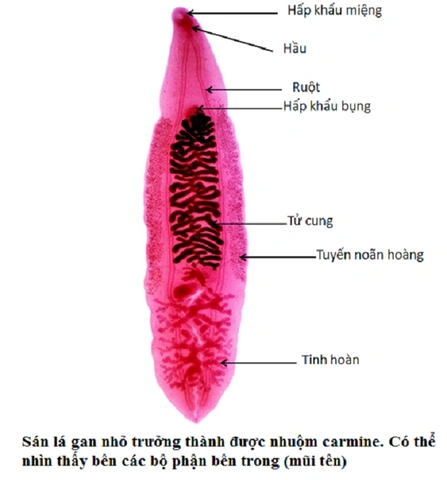 Hình Ảnh Trứng Sán Lá Gan Nhỏ: Đặc Điểm, Chẩn Đoán Và Phòng Ngừa Cho Người Bệnh