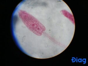 Hình Ảnh Trứng Sán Lá Gan Nhỏ: Đặc Điểm, Chẩn Đoán Và Phòng Ngừa Cho Người Bệnh