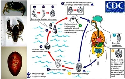 Xem Hình Ảnh Trứng Sán Lá Phổi: Đặc Điểm Nhận Dạng Và Ý Nghĩa Chẩn Đoán Xem Hình Ảnh Trứng Sán Lá Phổi: Đặc Điểm Nhận Dạng Và Ý Nghĩa Chẩn Đoán
