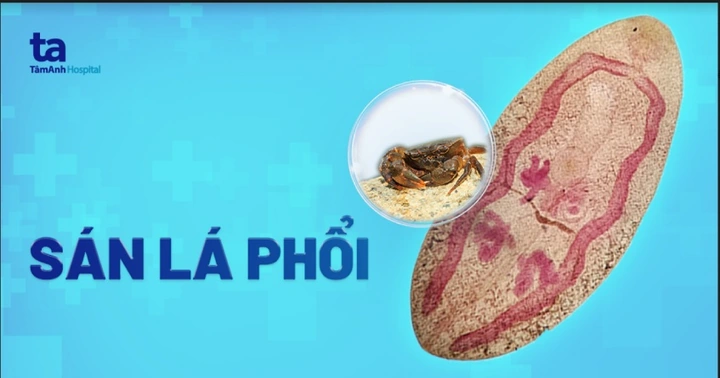 Xem Hình Ảnh Trứng Sán Lá Phổi: Đặc Điểm Nhận Dạng Và Ý Nghĩa Chẩn Đoán Xem Hình Ảnh Trứng Sán Lá Phổi: Đặc Điểm Nhận Dạng Và Ý Nghĩa Chẩn Đoán