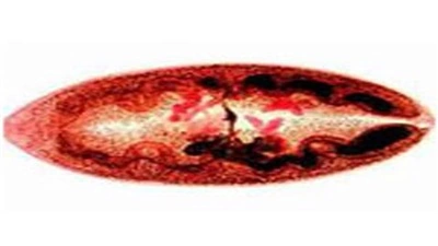 Xem Hình Ảnh Trứng Sán Lá Phổi: Đặc Điểm Nhận Dạng Và Ý Nghĩa Chẩn Đoán Xem Hình Ảnh Trứng Sán Lá Phổi: Đặc Điểm Nhận Dạng Và Ý Nghĩa Chẩn Đoán